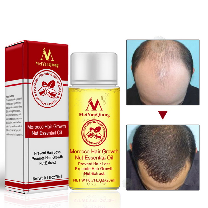 20ml Men Women Nut Hair Oil Hair Care Essential Oil Hair Growth