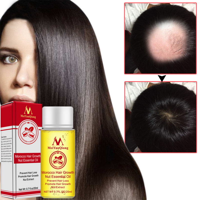 20ml Womens Mens Nut Hair Oil Hair Care Oil Hair Growth Oil Ebay